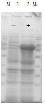 Fully human monomolecular antibody 7d-mfc against Clostridium perfringens alpha toxin and its application