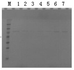 Fully human monomolecular antibody 7d-mfc against Clostridium perfringens alpha toxin and its application