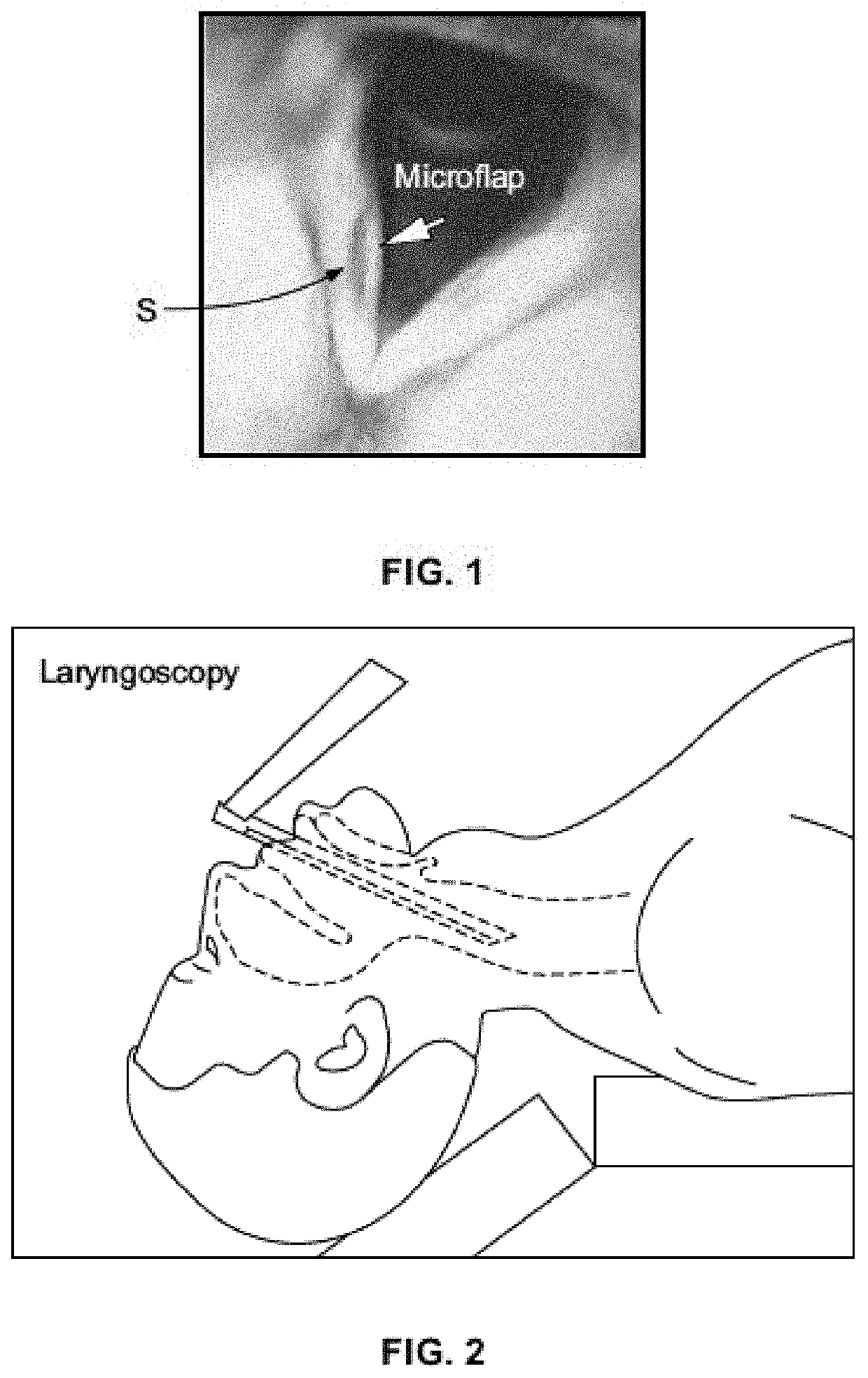 Handheld printer for enhanced mixing and delivery of multi-component polymers/biomaterials