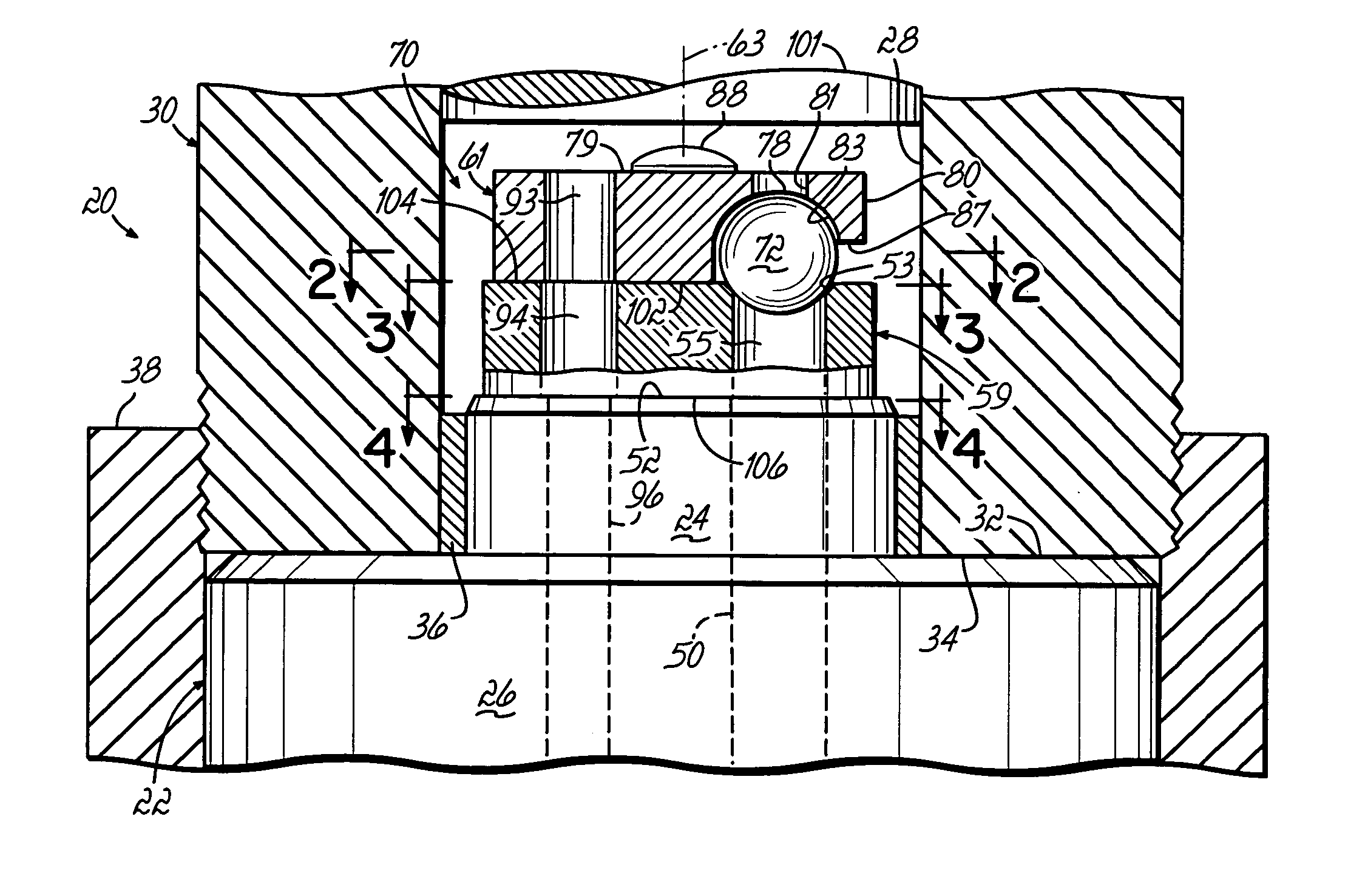 Inlet check valve with removable seat