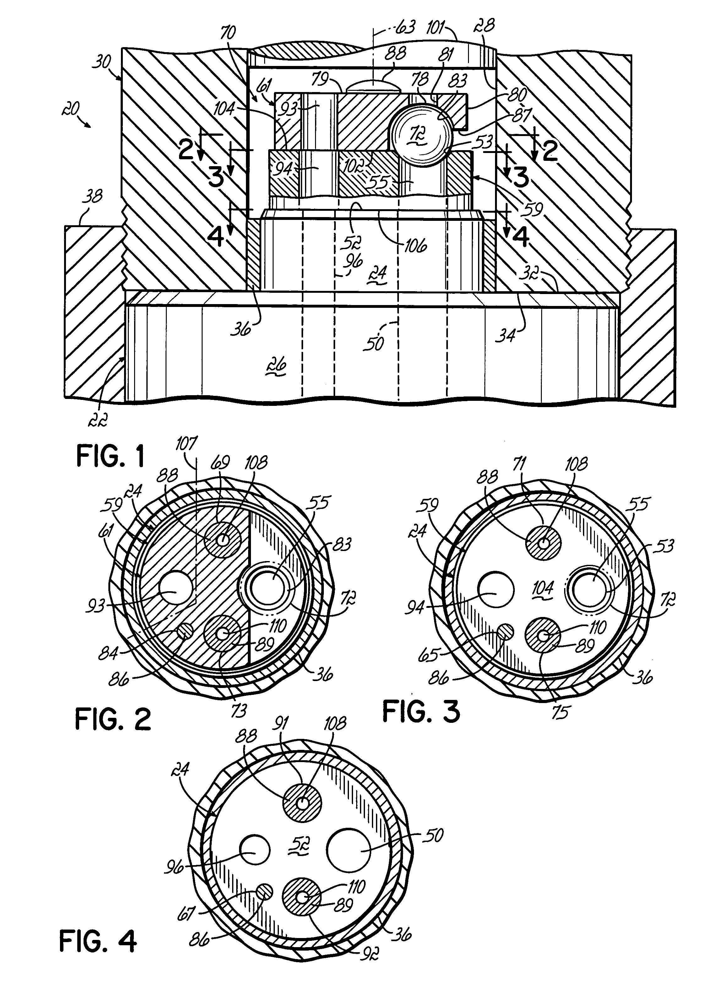 Inlet check valve with removable seat