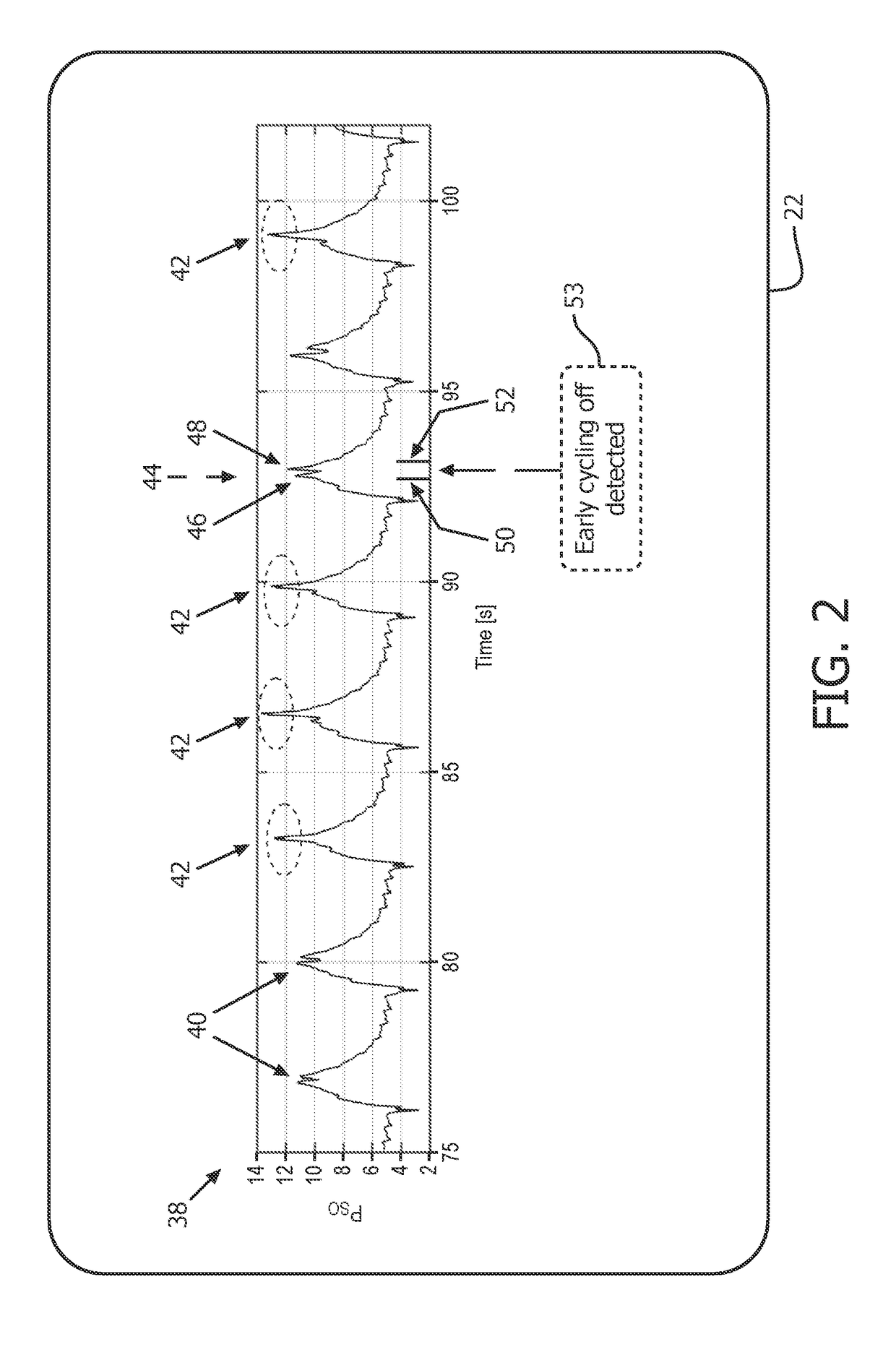 Anomaly detection device and method for respiratory mechanics parameter estimation