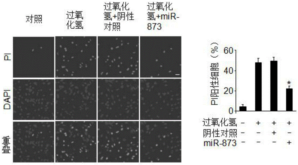 Pharmaceutical composition containing miRNA-873 and application thereof