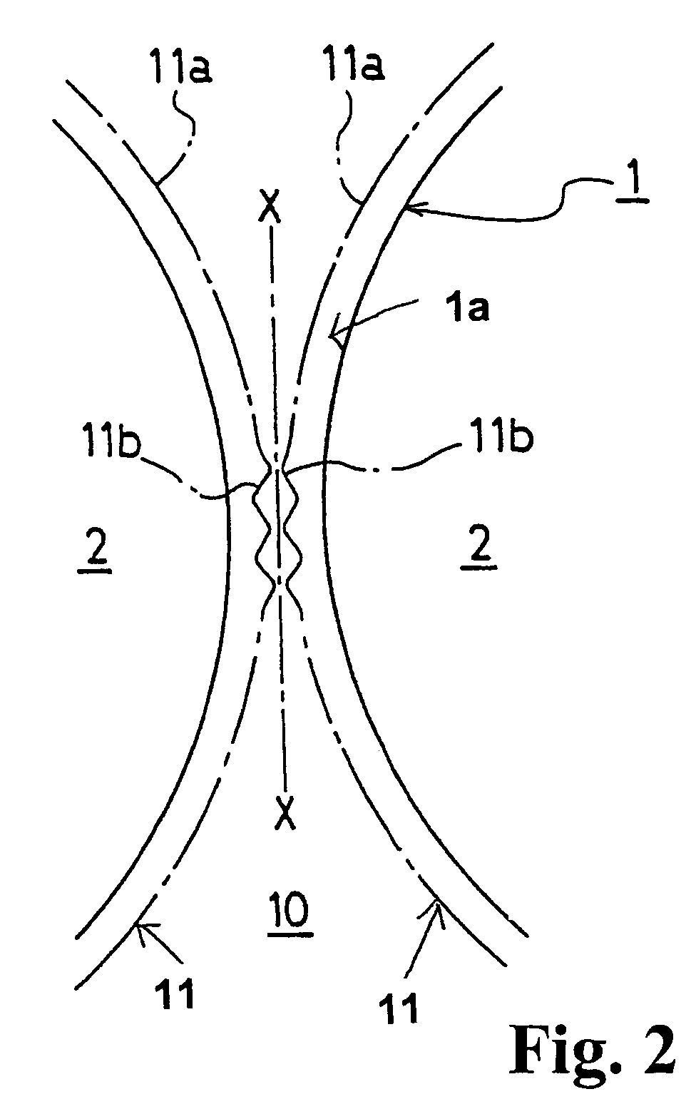 Cylinder head gasket