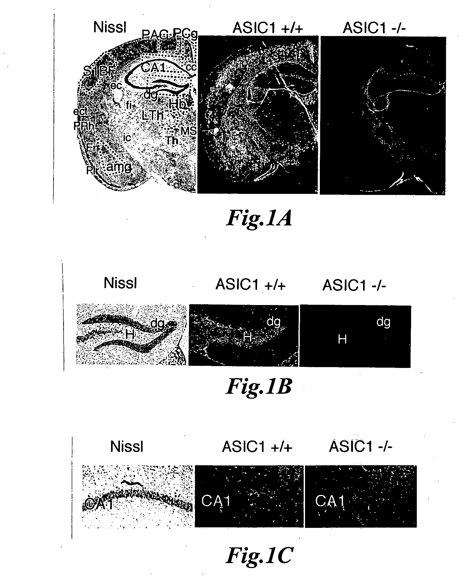 Novel compositions and methods for modulation of the acid-sensing ion channel (ASIC) for the treatment of anxiety and drug addiction