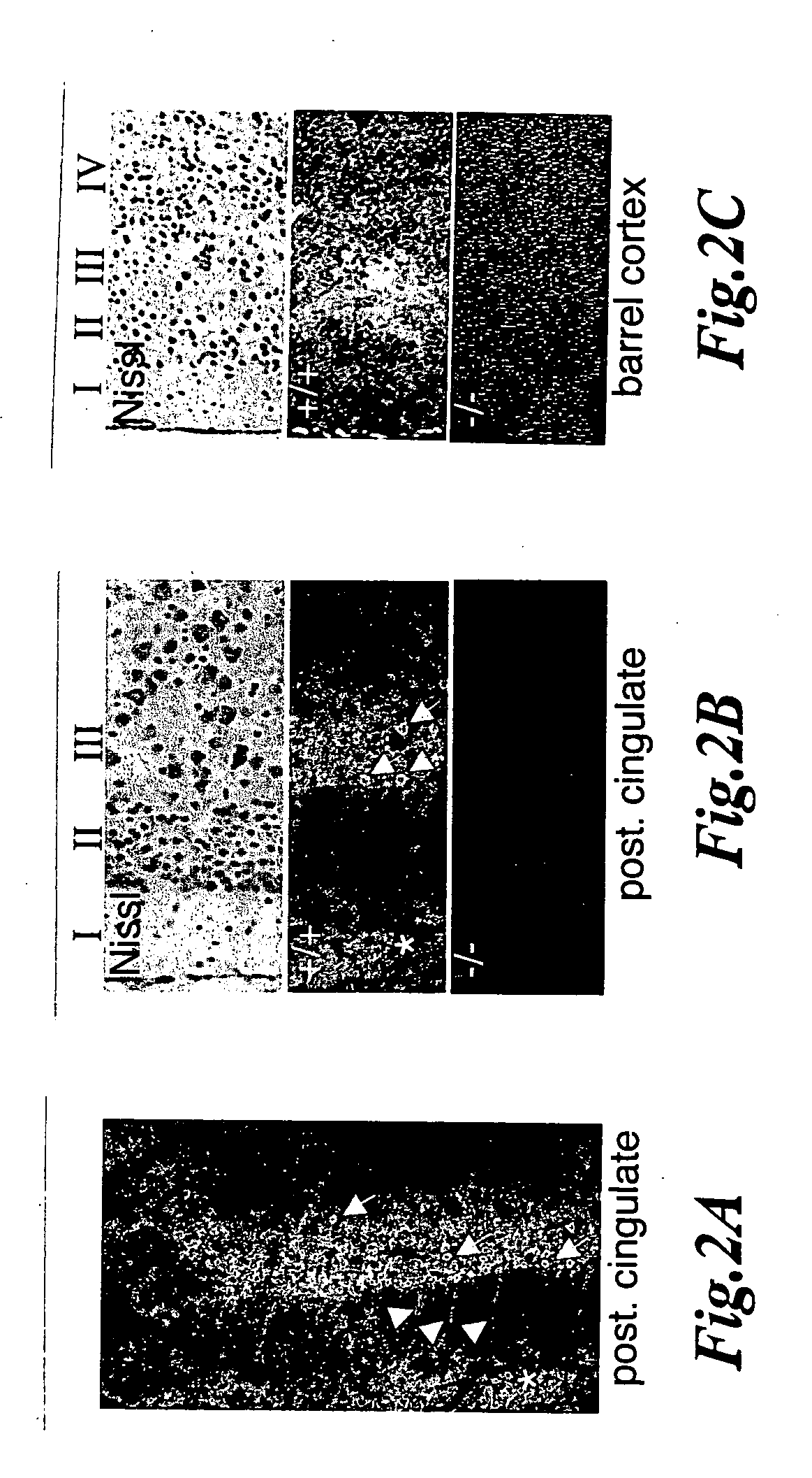 Novel compositions and methods for modulation of the acid-sensing ion channel (ASIC) for the treatment of anxiety and drug addiction