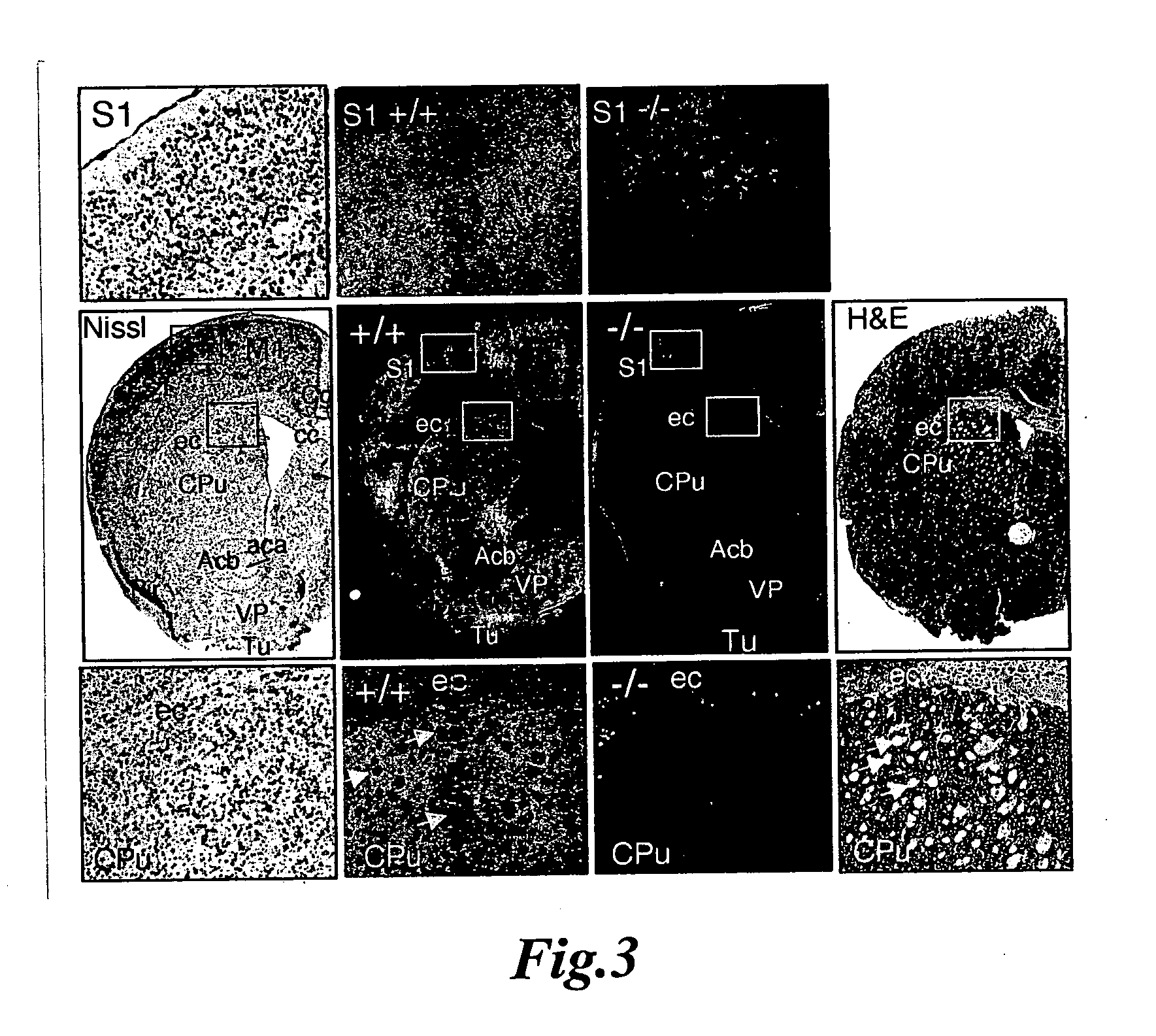Novel compositions and methods for modulation of the acid-sensing ion channel (ASIC) for the treatment of anxiety and drug addiction