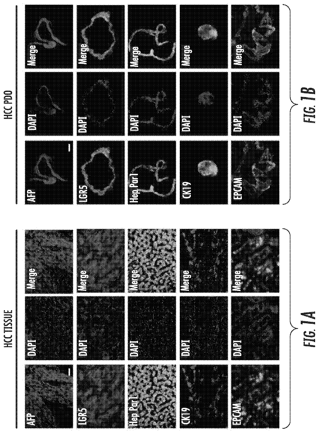 Compositions and methods of treating liver cancers