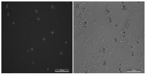 Method for separating liver cells and hepatic stellate cells in animals infected with echinococcus multilocularis