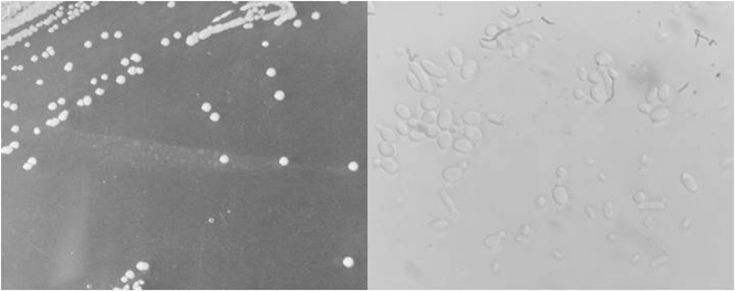 Wickerhamomyces anomalus capable of producing ester at high yield and application thereof