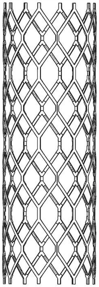 Microtextured arterial vascular stent and preparation device and method thereof