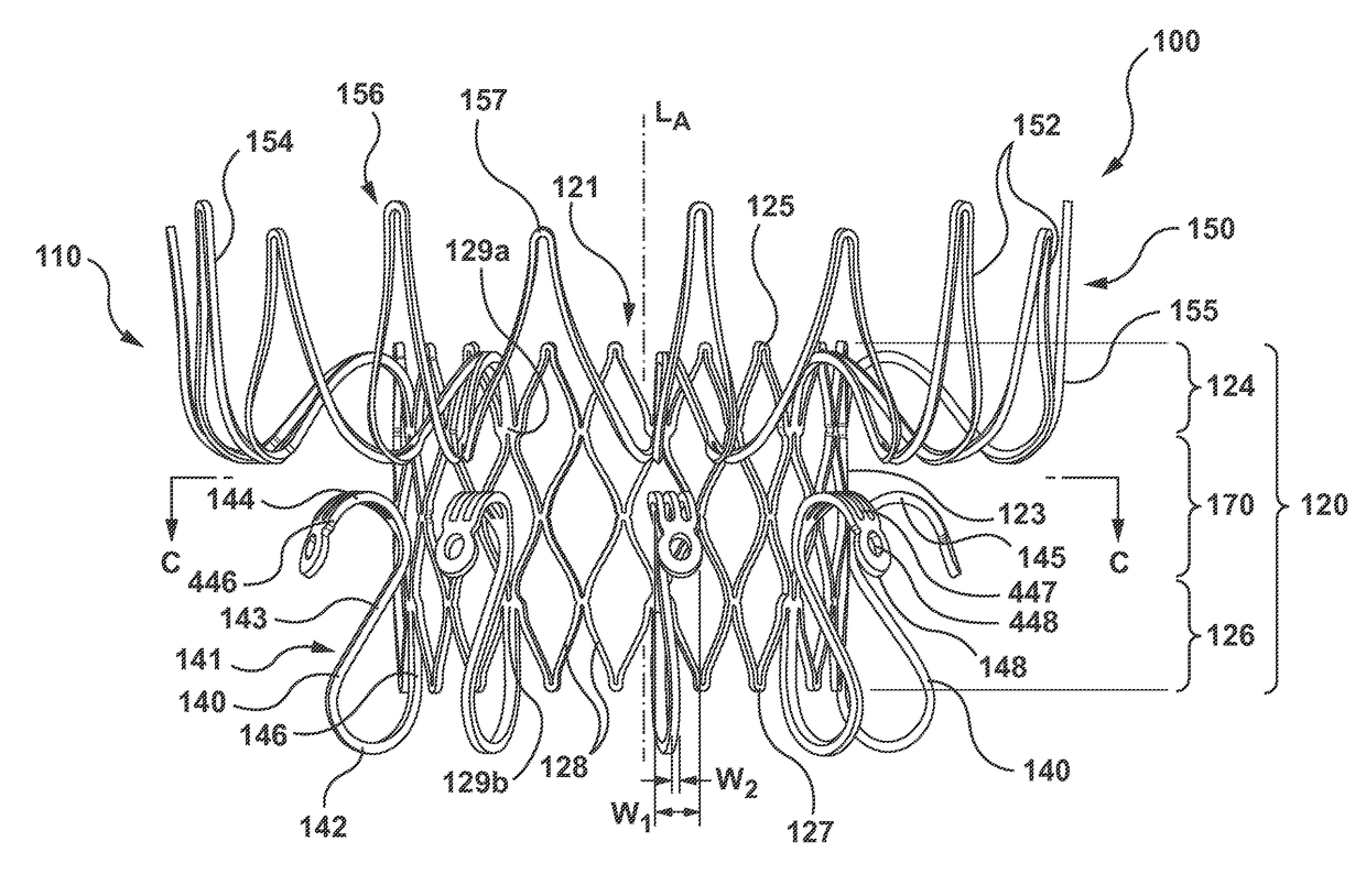 Heart Valves Prostheses and Methods for Percutaneous Heart Valve Replacement