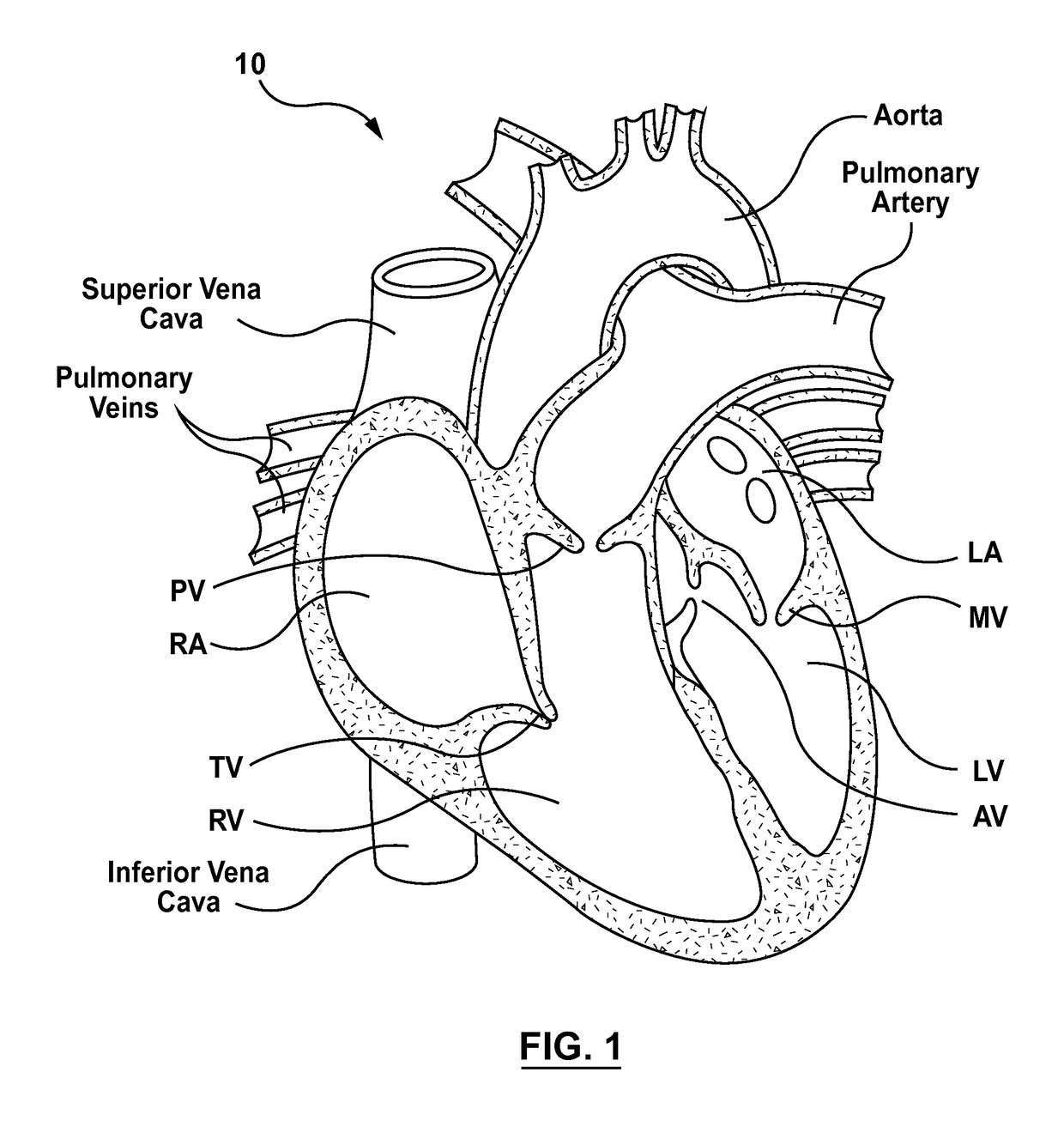 Heart Valves Prostheses and Methods for Percutaneous Heart Valve Replacement