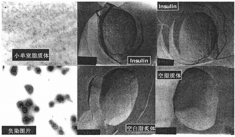 Oral suspension of liposome-encapsulated insulin lyophilized preparation and preparation process thereof