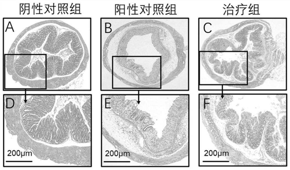 Application of MMP9 inhibitor in preparation of medicine for preventing and/or treating colitis or colon cancer