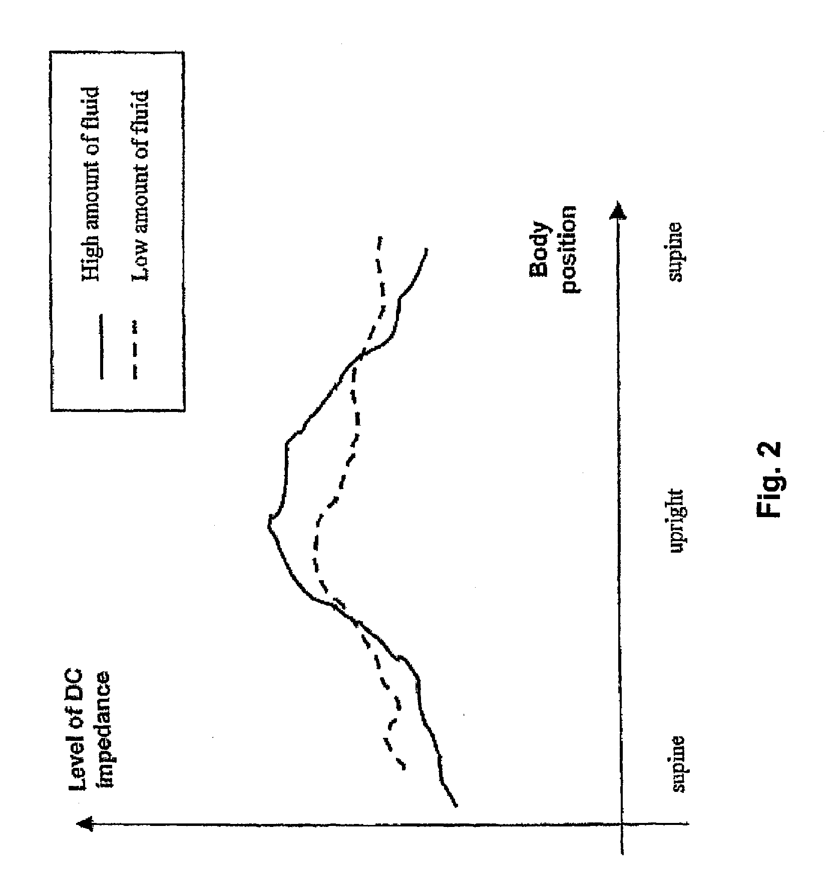 Method and implantable medical device for assessing a degree of pulmonary edema of a patient