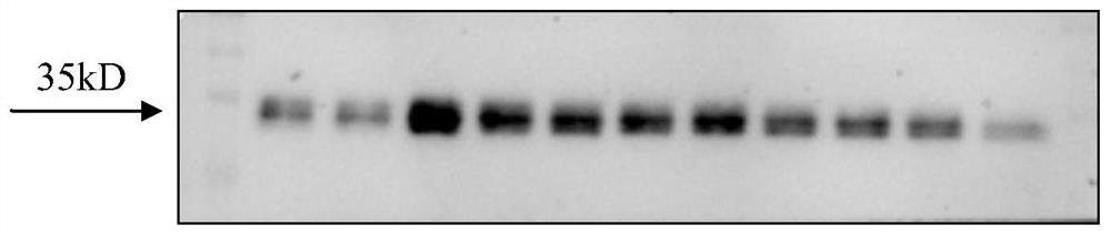 The medical use and pharmaceutical composition thereof of vsig3 small molecule inhibitor