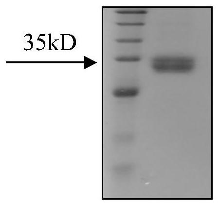 The medical use and pharmaceutical composition thereof of vsig3 small molecule inhibitor