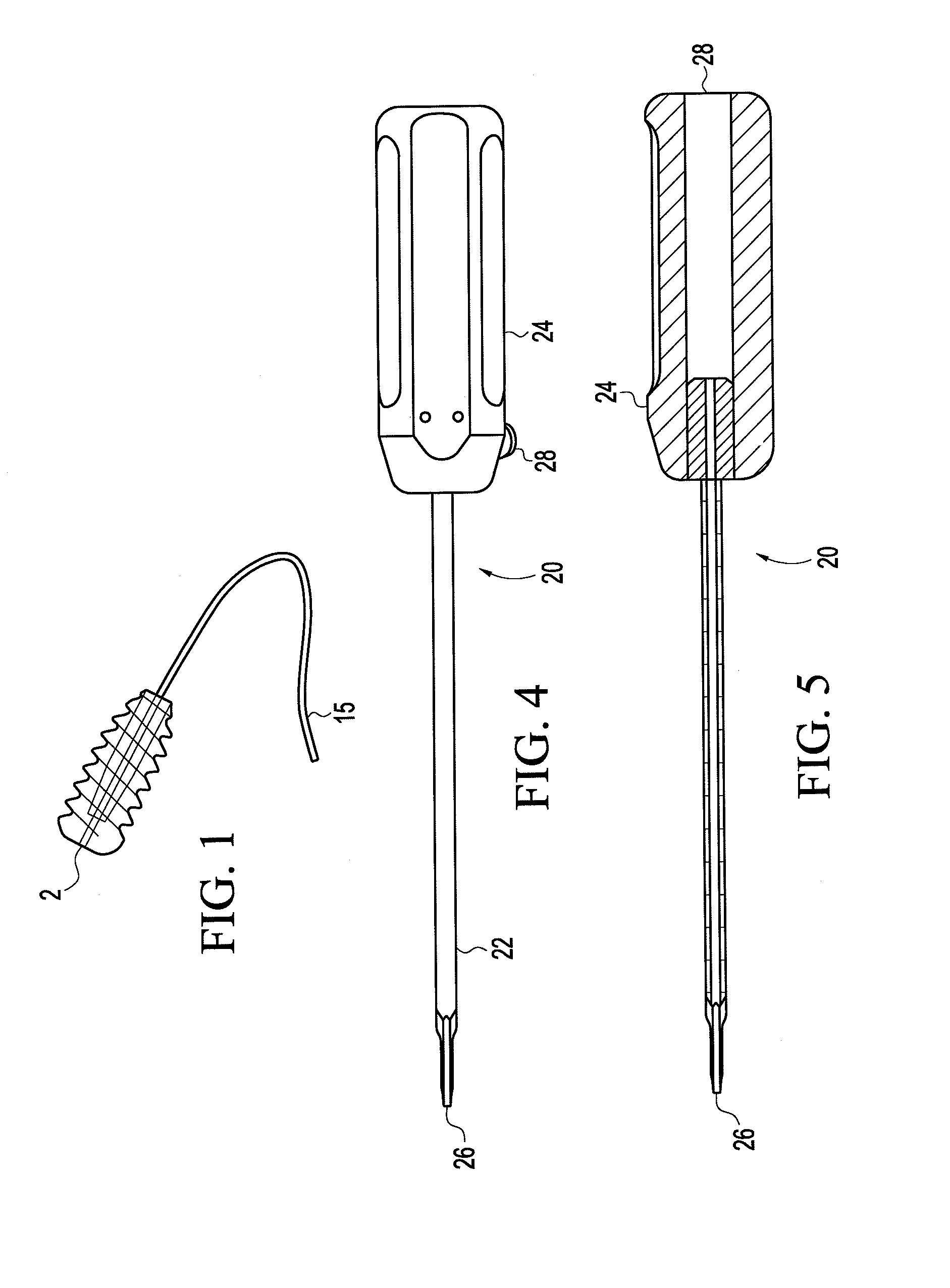 Retrograde fixation technique with insert-molded interference screw