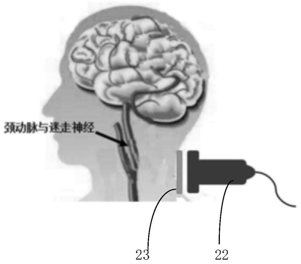 A blood-brain barrier permeability regulation device, method and storage medium