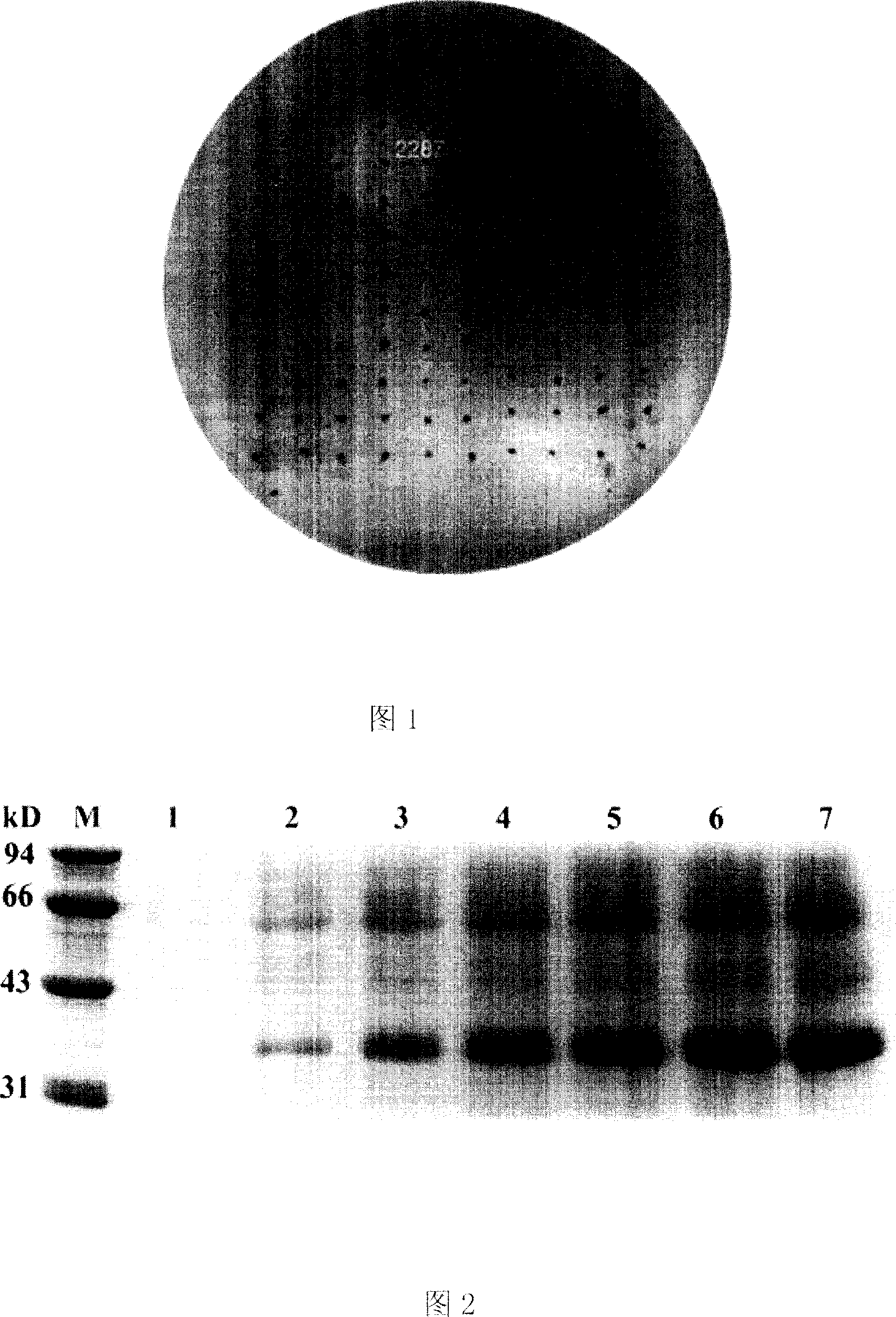 Beta-glucanase, encoding gene thereof, recombinant plasmid and bacterial strain and uses thereof