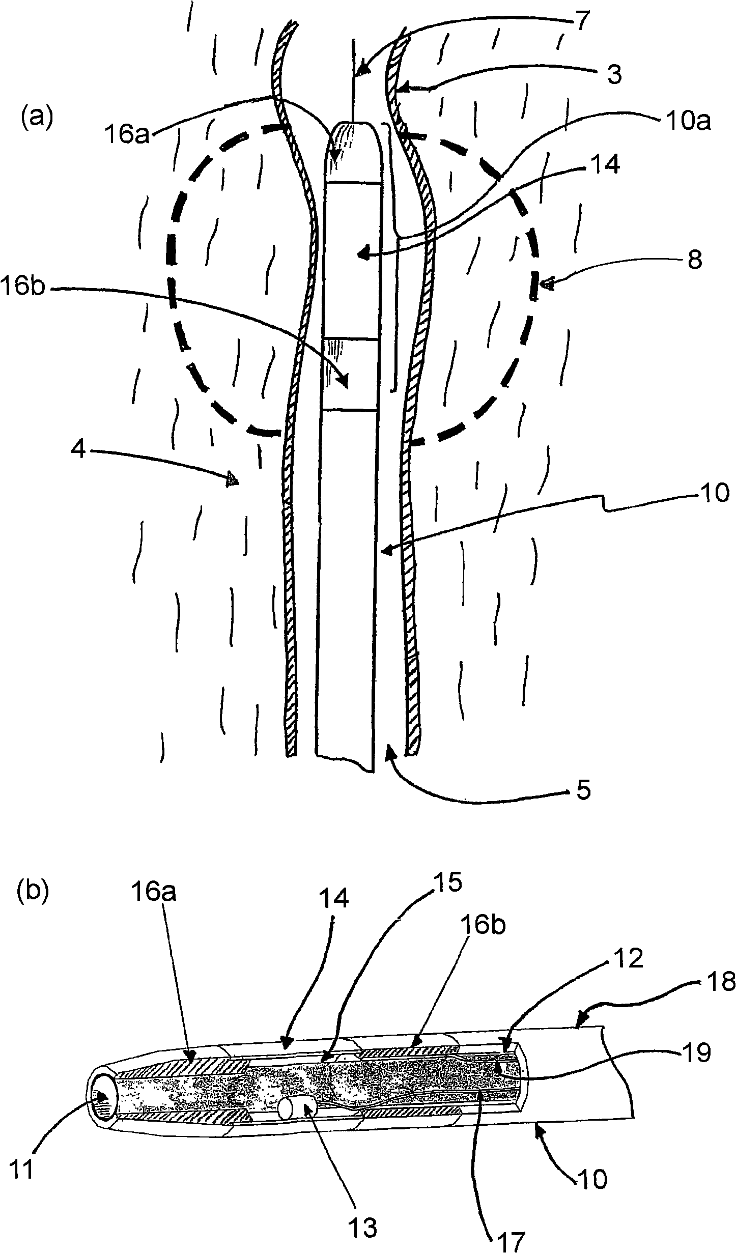 Vessel sealing device and methods