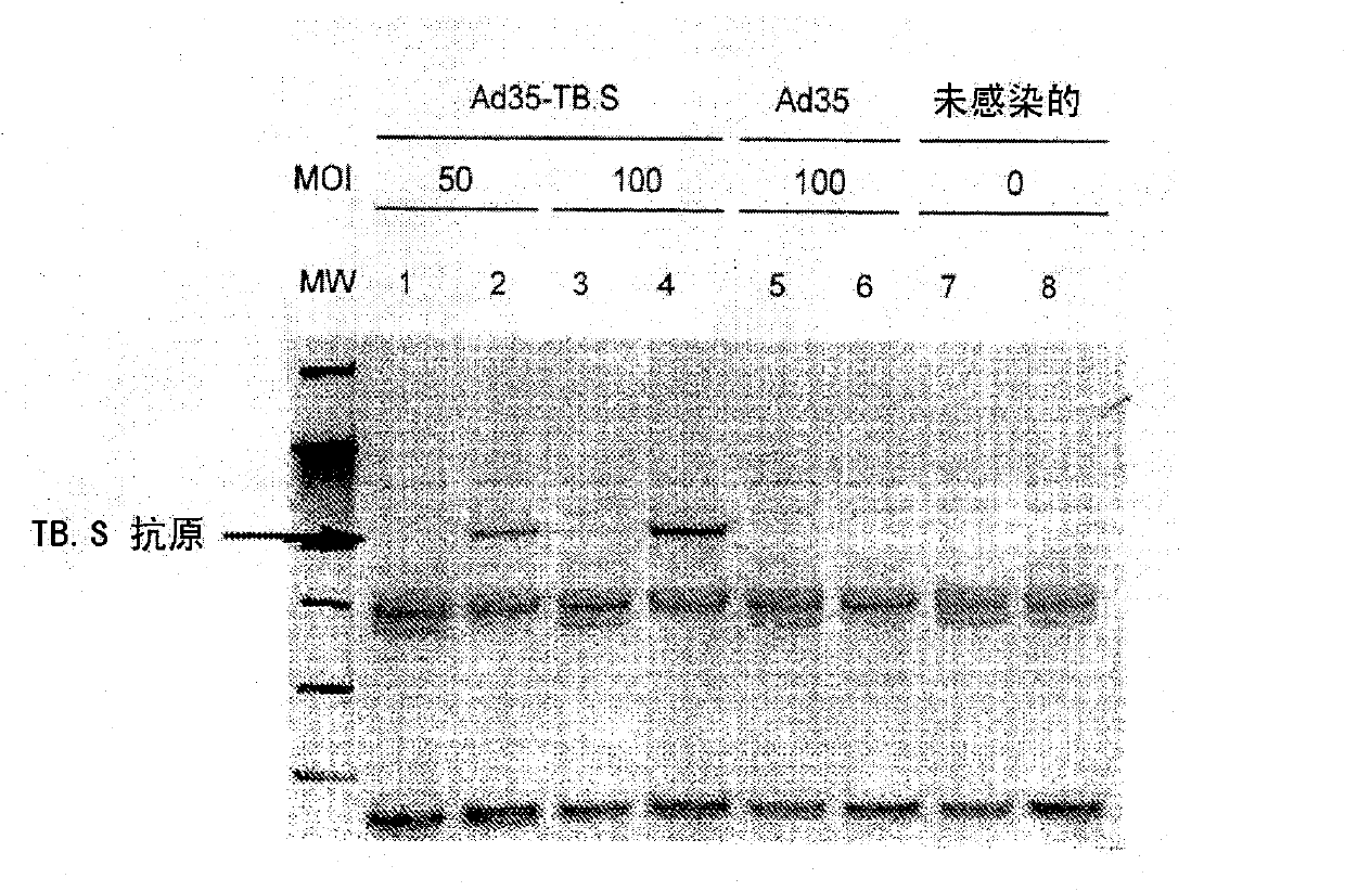 Enhancement of transgene expression from viral-based vaccine vecors by expression of suppressors of the type i interferon response