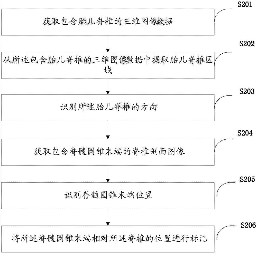 Target image recognition method and device and ultrasonic equipment thereof