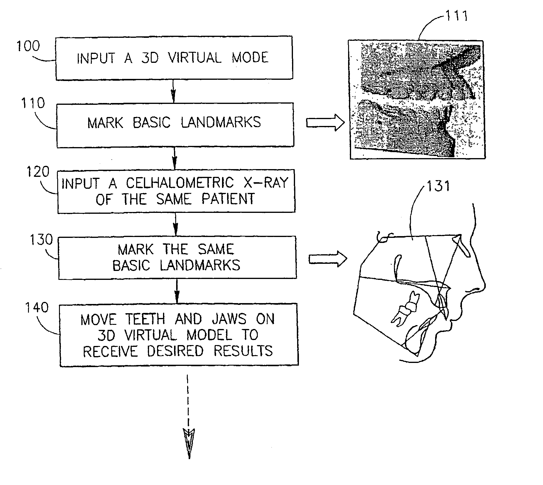 Dental image processing method and system