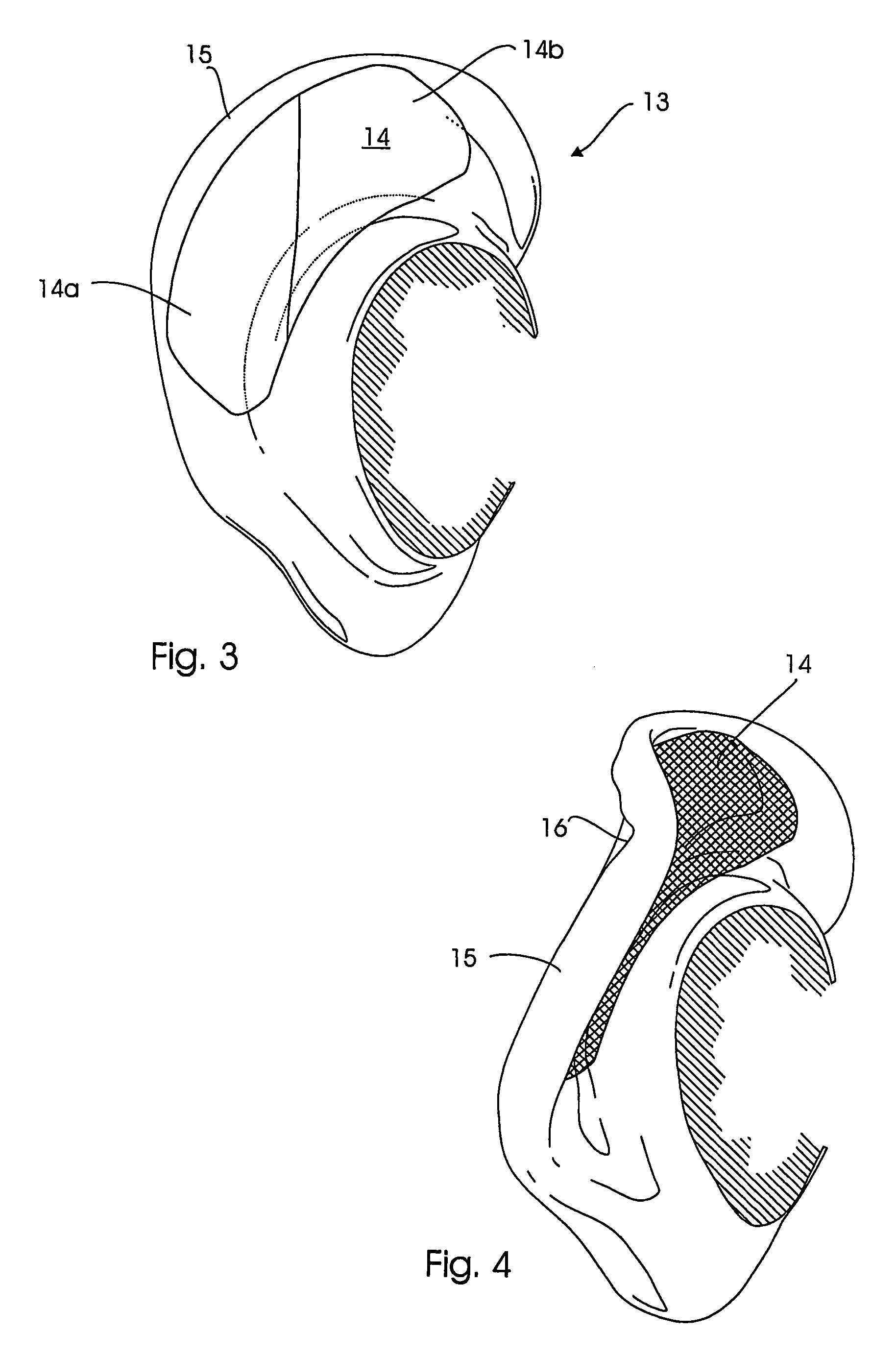 Clamp for correcting the external ear and method of using the clamp