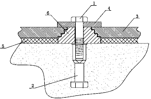 Foundation bolt component