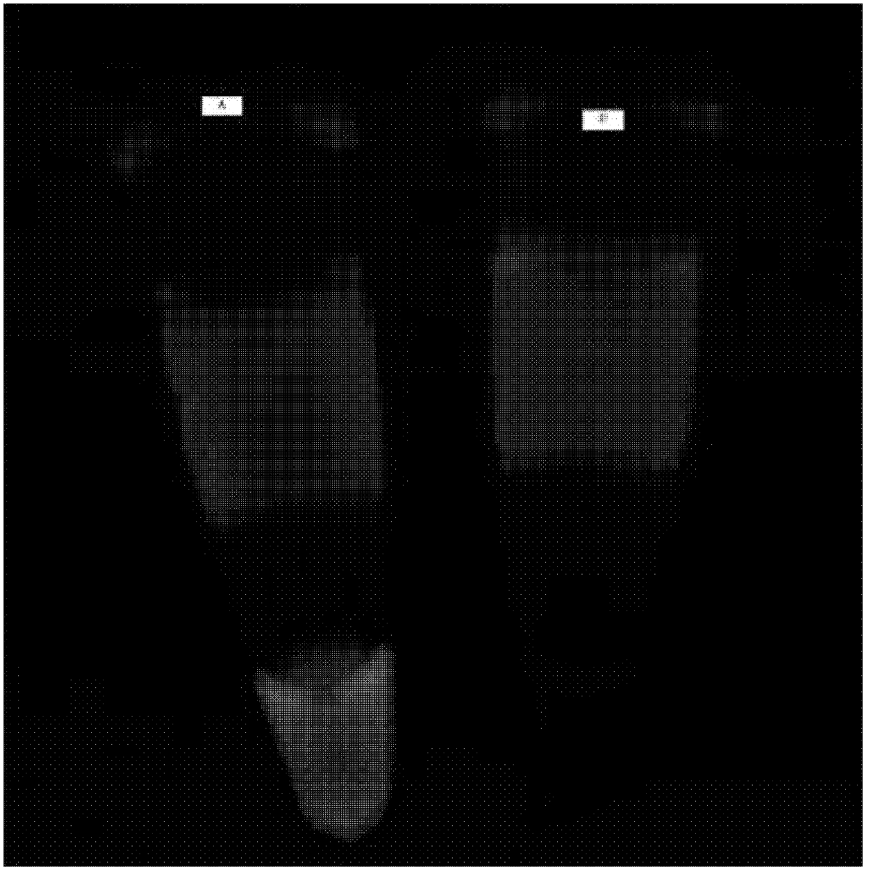 Duck viral hepatitis type 1 RT-LAMP detection kit and detection method thereof