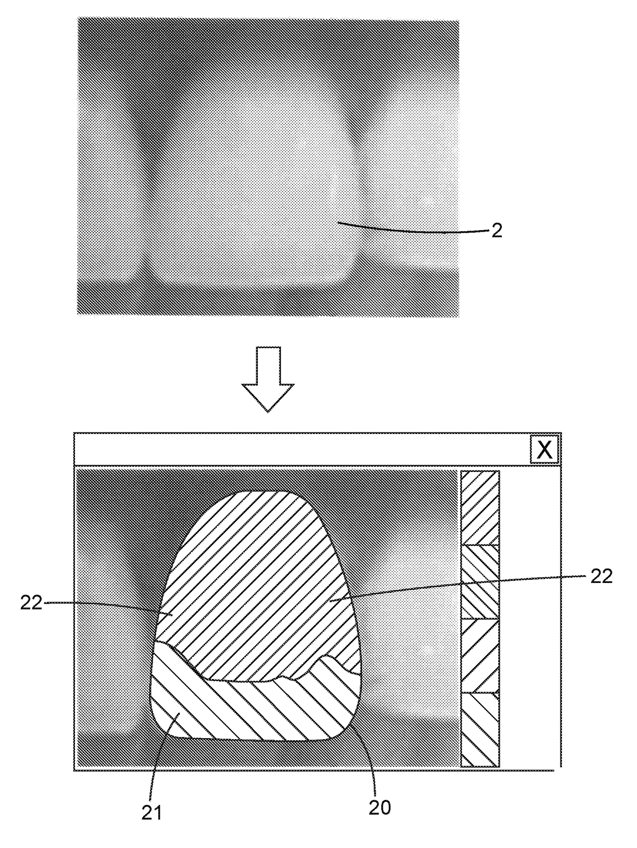 A method of making a dental restoration