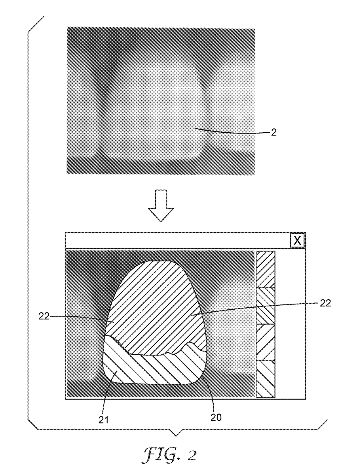A method of making a dental restoration