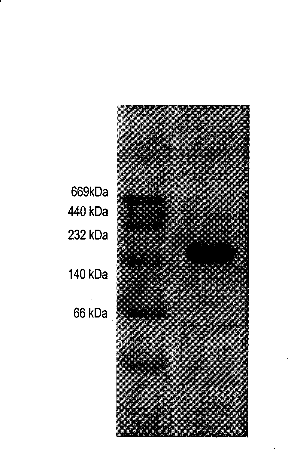 Arthrobacter, uses for produced xanthine oxidase and production method thereof