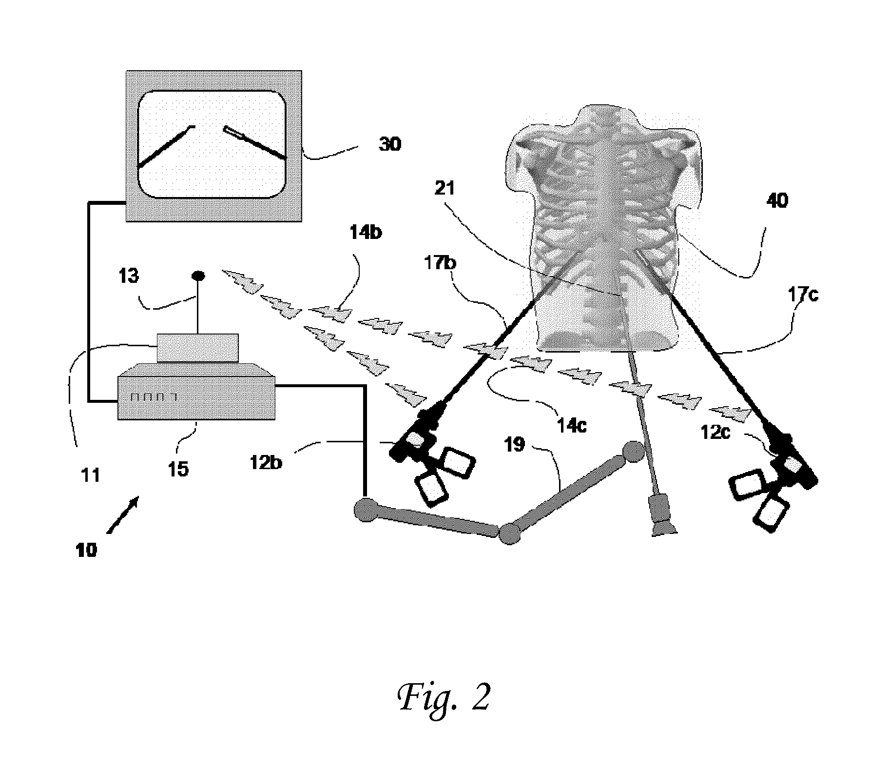 Device and methods of improving laparoscopic surgery