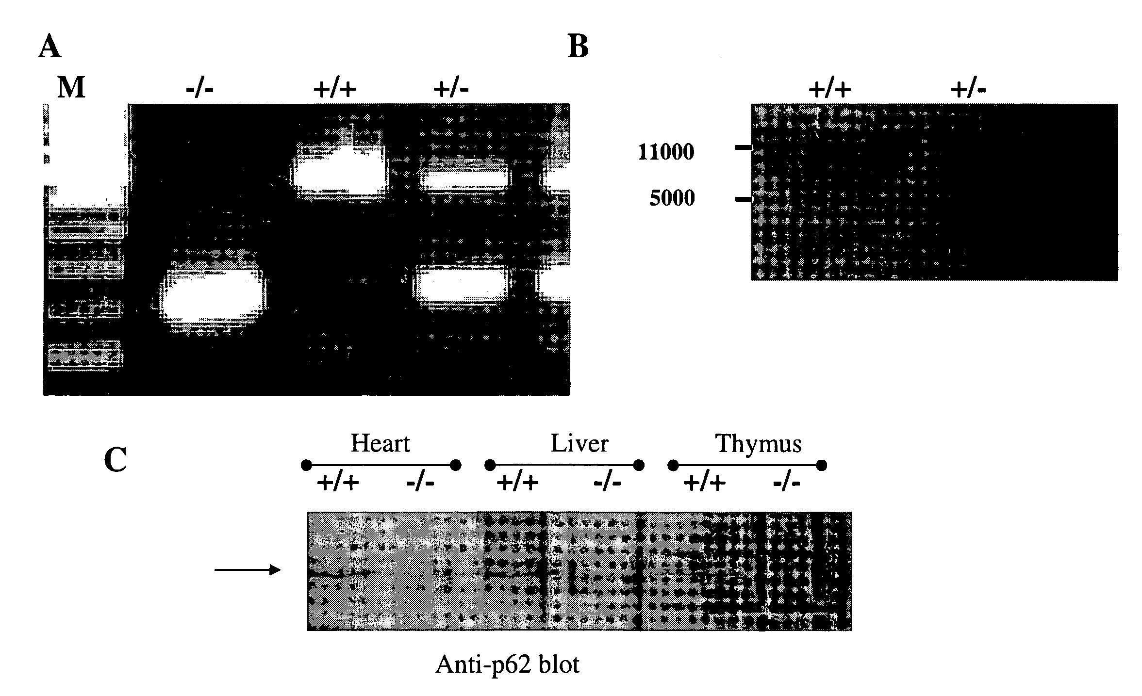 ROLE OF p62 IN AGING-RELATED DISEASE