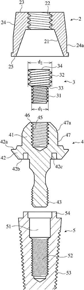 Keeper for implant, assembly thereof, and method for affixing keeper