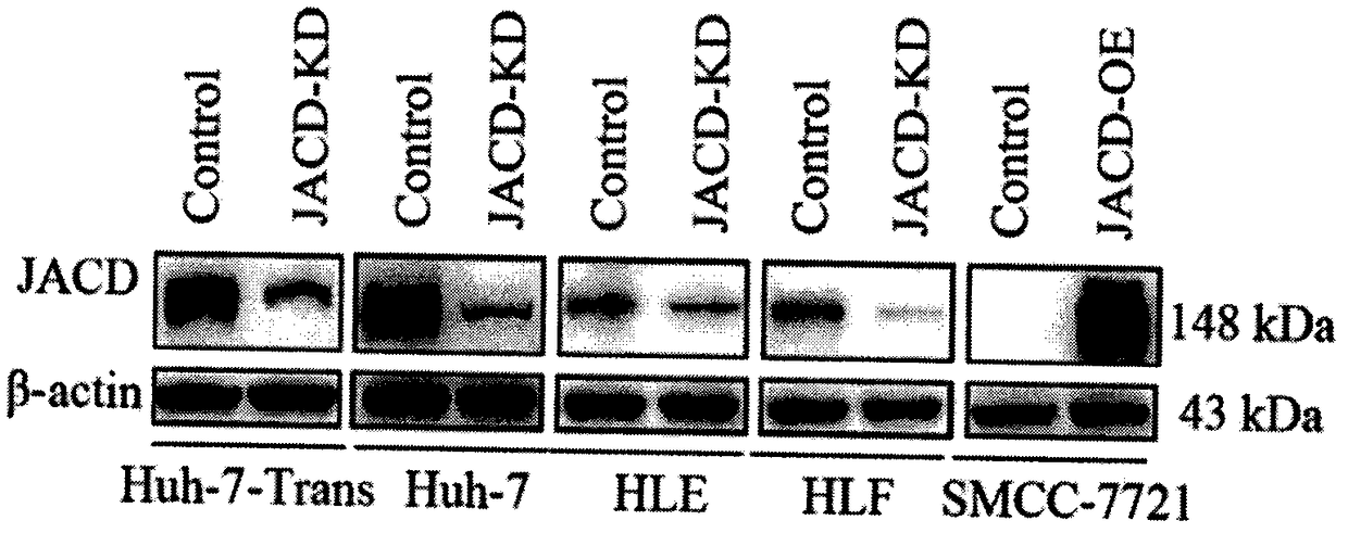 Cancer promotion gene JCAD and application by taking the same as target to prepare drugs for treating liver cancer