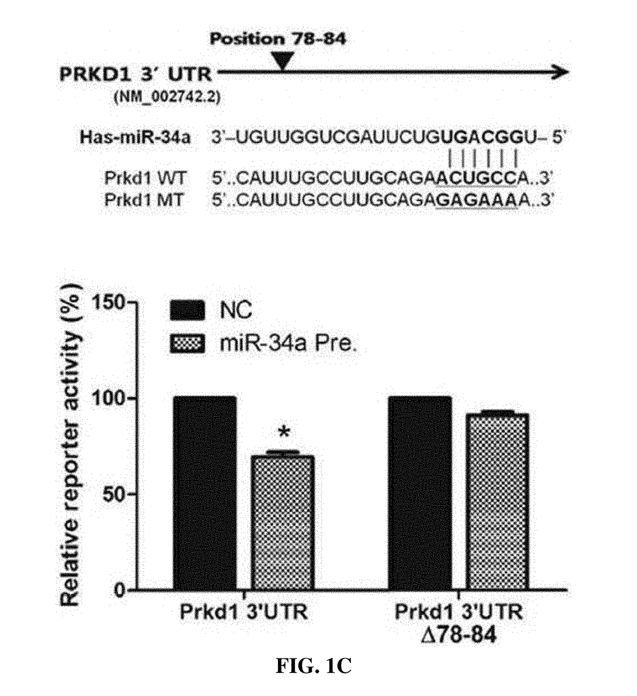 Therapeutic compositions for breast cancer containing protein kinase D1 inhibitor