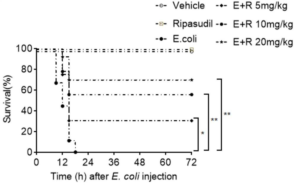 Application of ripasudil in preparation of medicine for treating bacterial infection