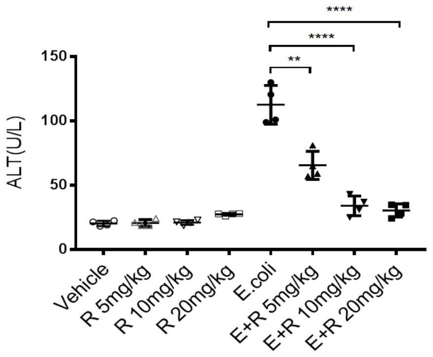 Application of ripasudil in preparation of medicine for treating bacterial infection