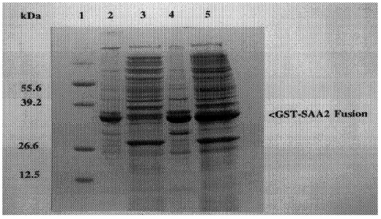 Method for the quantitative measurement of human acute phase serum amyloid A protein; recombinant protein; specific antibody