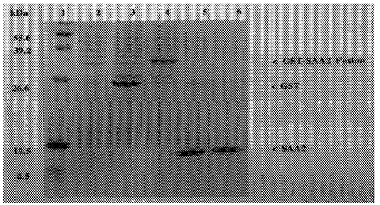 Method for the quantitative measurement of human acute phase serum amyloid A protein; recombinant protein; specific antibody