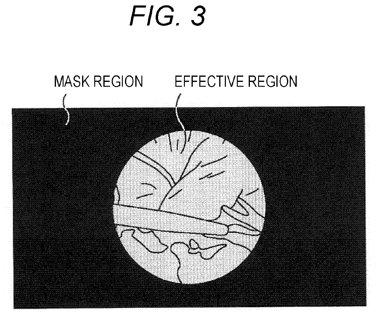 System with endoscope and image sensor and method for processing medical images