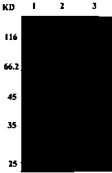 Human cardiac troponin I hybridoma cell line 7H4 and monoclonal antibody and application