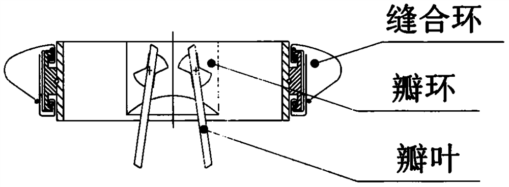 An annular artificial heart valve