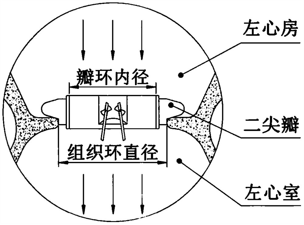 An annular artificial heart valve