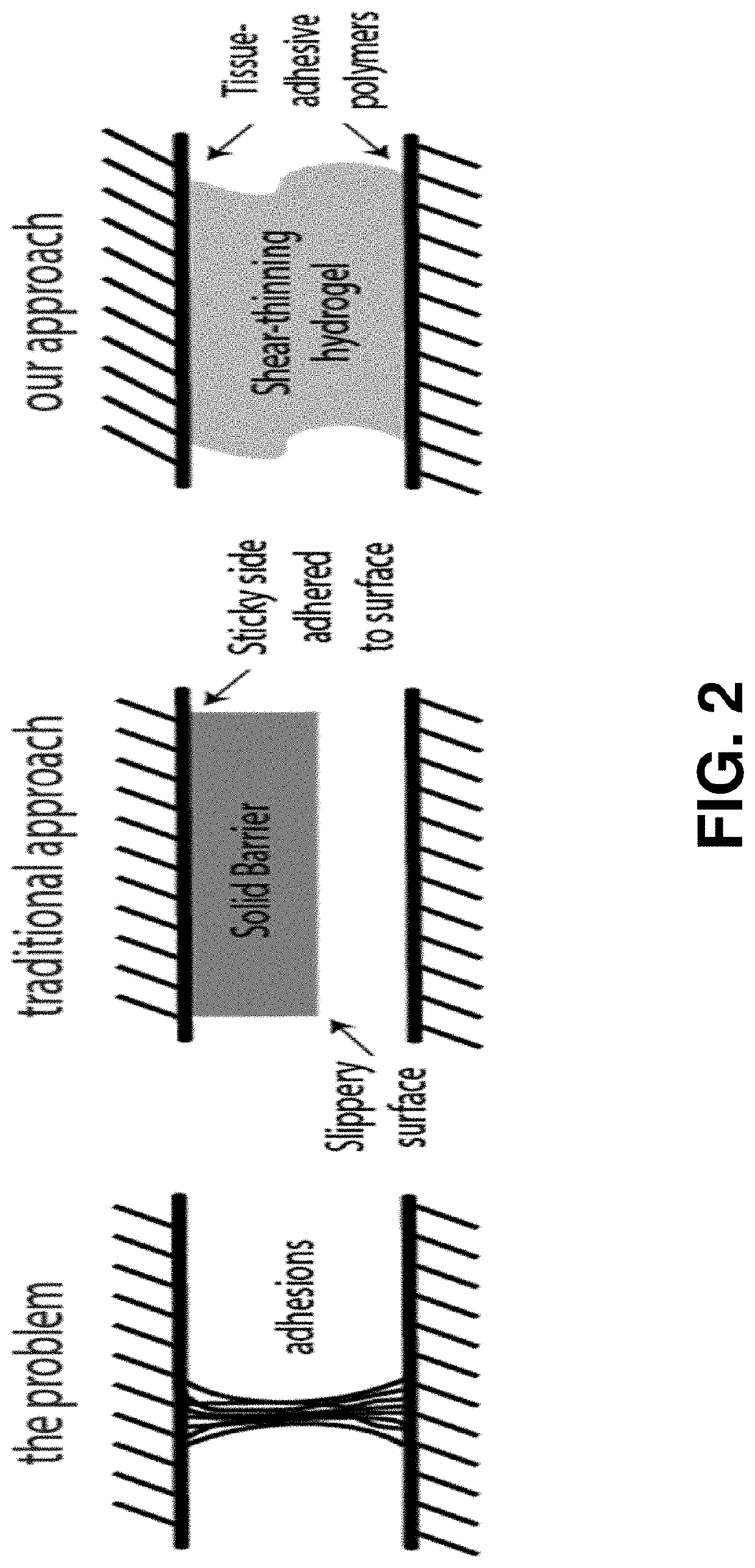 Adhesion prevention with shear-thinning polymeric hydrogels