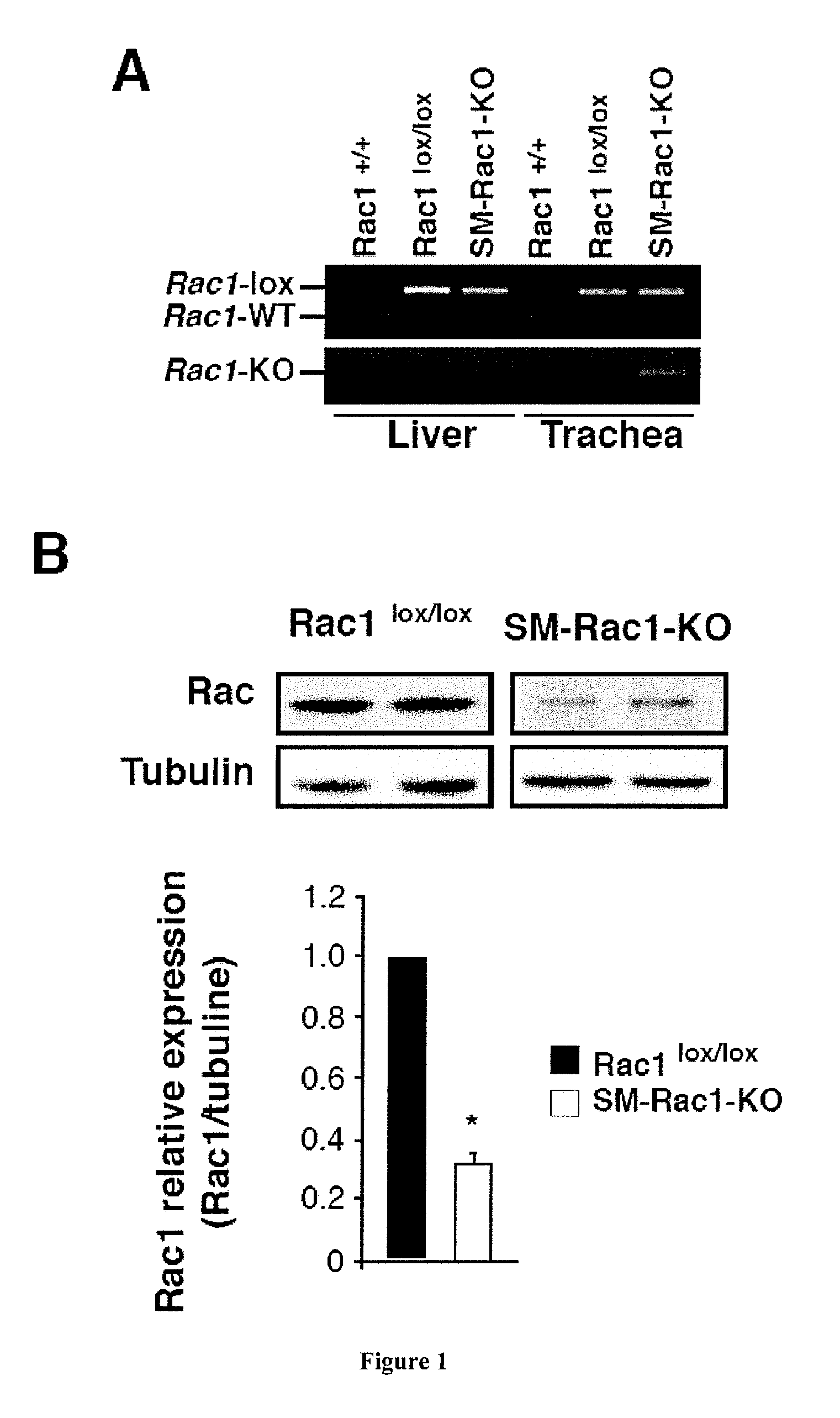 RAC1 Inhibitors for Inducing Bronchodilation